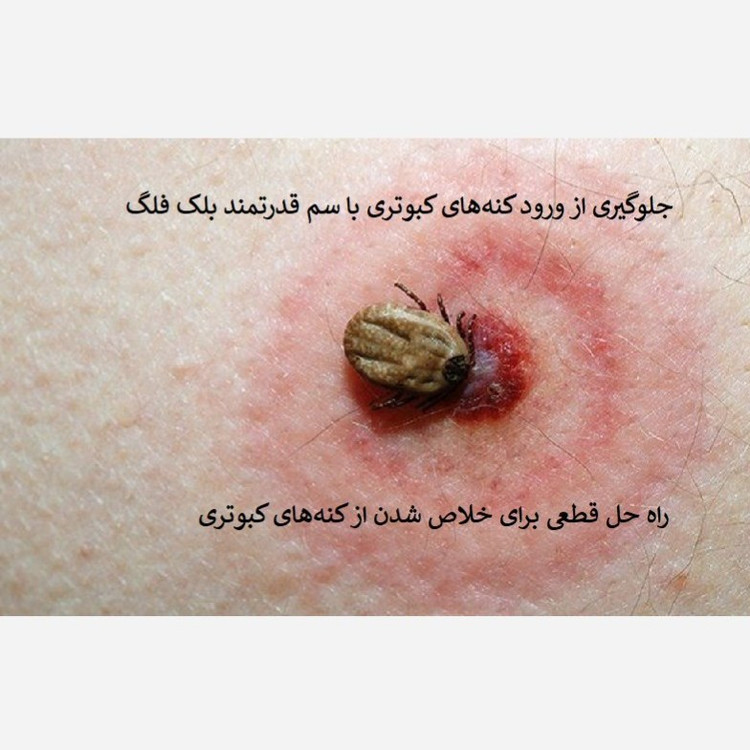 نابودی فوری کنه کبوتری با بلک فلگ