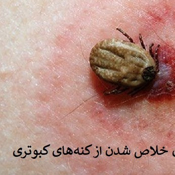 کنترل کنه با مکس فورس