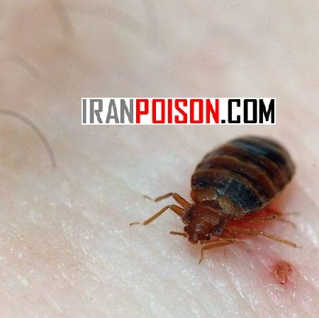 کنترل ساس با پست ساید