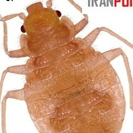 کنترل ساس با پست ساید
